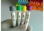 Free HIV and STD Testing