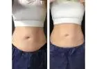 Best Treatment for Body Contouring in Prospect