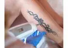 Best Laser Tattoo Removal in Scarborough