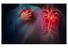 Understanding Heart disease and stroke among Americans