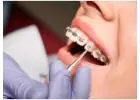 Best Orthodontist in Waterloo