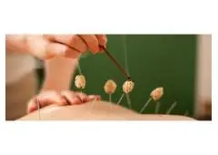 Best Acupuncture in Jurong West