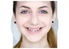 Transform Your Smile with Hornsby Orthodontics at White Cross Dental